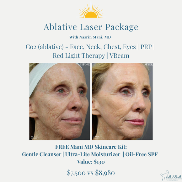 August Promo | CO2 Package
