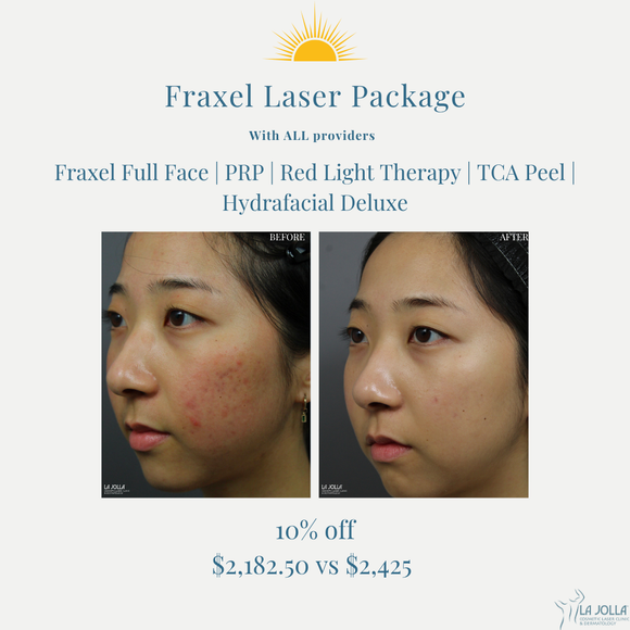 August Promo | Fraxel Package