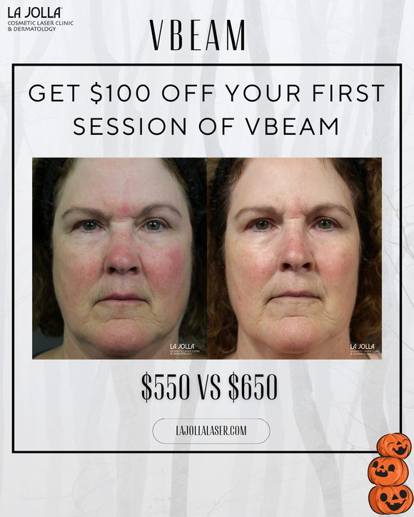 October Promotion | VBEAM