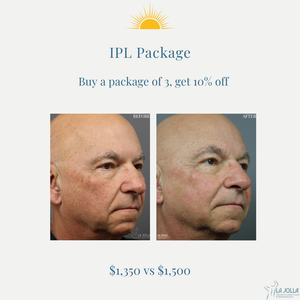 August Promo | IPL