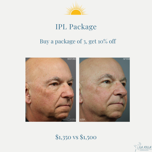August Promo | IPL